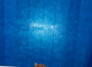 По убедливиот пораз од Ливерпул, Фердинанд заврши во шок-соба