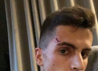 Ѕвездата на Сити претепана и ограбена