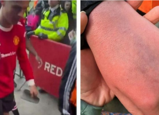 Роналдо по поразот удри момче со аутизам, го скрши неговиот мобилен, па се извини (ВИДЕО)