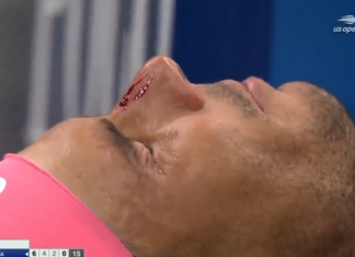 Надал си го раскрвари носот, но успеа да се пласира во третото коло на УС Опен (ВИДЕО)