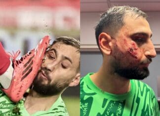 Донарума паузира неколку недели