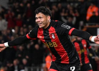 Еванилсон ја оперираше скршената нога