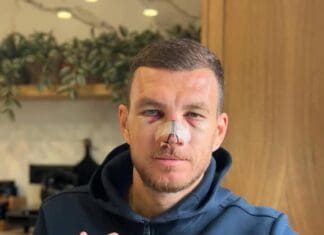 Џеко ги покажа повредите по дуелот со Романија