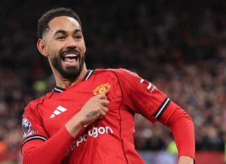 Куња има потрес на мозокот, не се знае дали ќе игра против Евертон