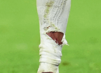 Фотографија од ногата на Мбапе стана вирална: Како е можно ова да не е црвен картон?